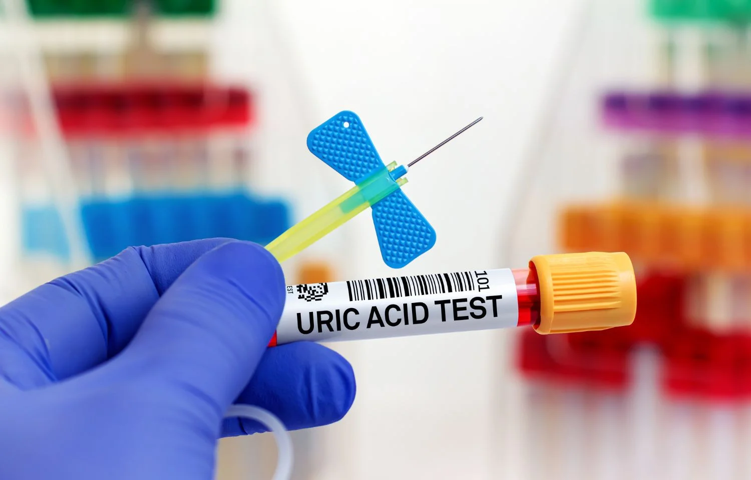 el queso aumenta el acido urico