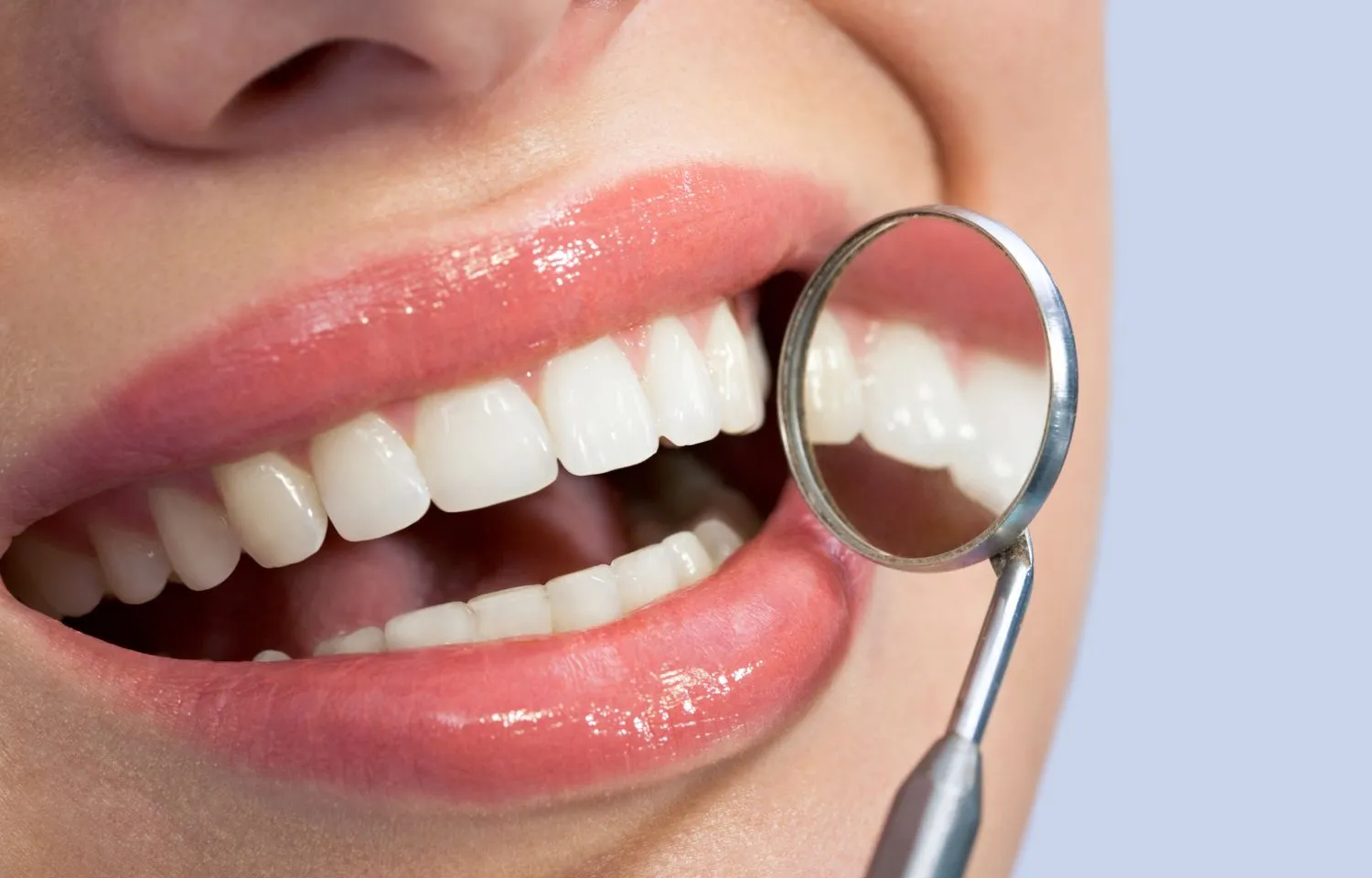 el queso no provoca caries