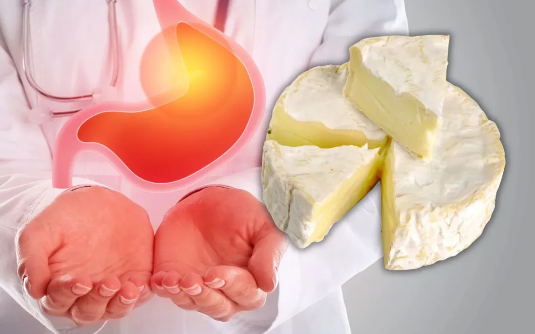 el queso produce acidez